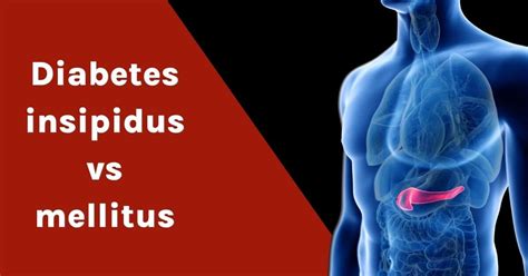 Diabetes Insipidus E Mellitus Braincp