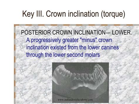 Andrews 6 Keys Of Normal Occlusion Certified Fixed Orthodontic Courses By Indian Dental Academy