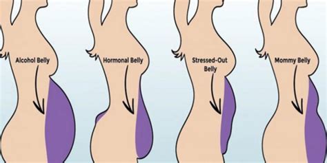 Types Of Fat Belly And How To Manage It Nature’s Pharmacy