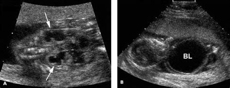 Genitourinary Tract Radiology Key