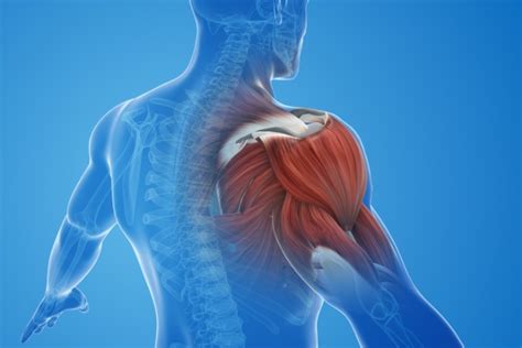 Alleviating Shoulder Impingement The Impact Of Upper Cervical