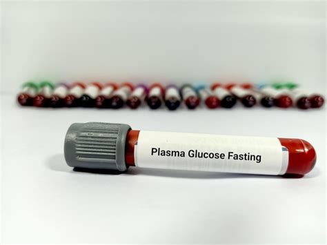 Premium Photo Blood Samples For Plasma Glucose Fasting Fgp Test