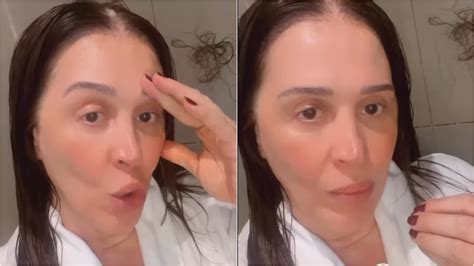 Claudia Raia revela problema dermatológico após gravidez Surreal