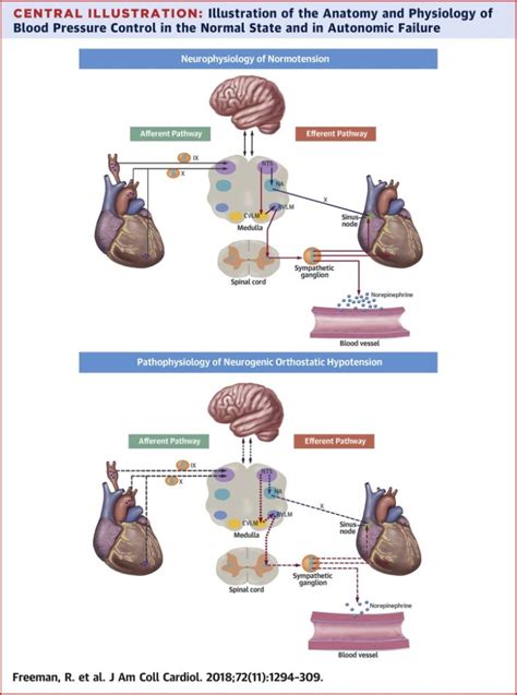 Neurogenic Orthostatic Hypotension Parkinson S Disease