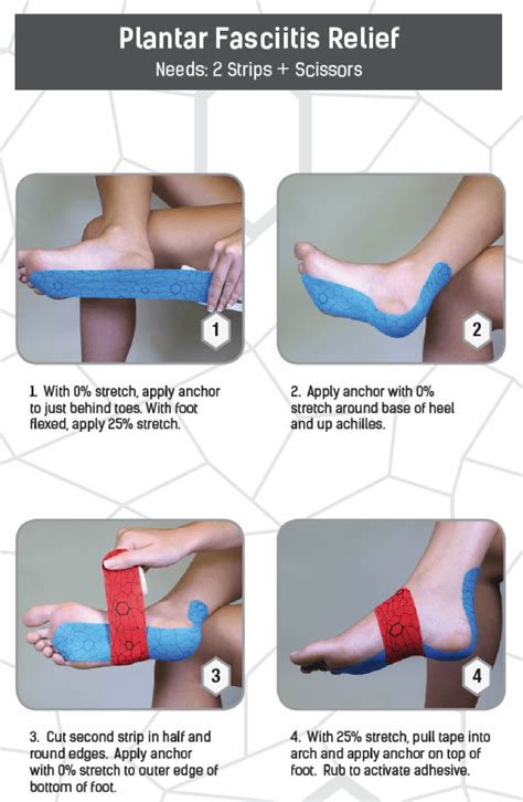 Plantar Fasciitis Taping Diagram Taping Plantar Fasciitis Dy