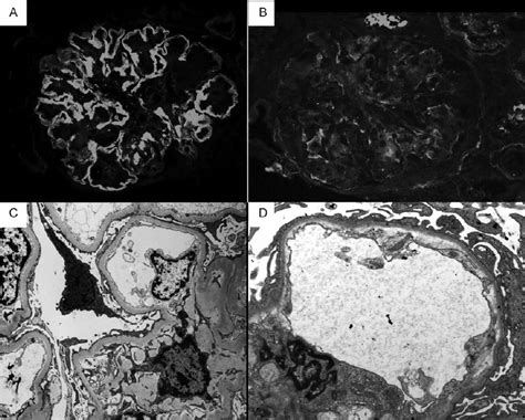 A Immuno Fl Uorescence Evaluation Revealed An Intense Linear