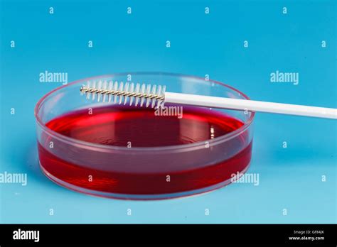 Cultivo De Bacterias Hisopo Fotograf As E Im Genes De Alta Resoluci N