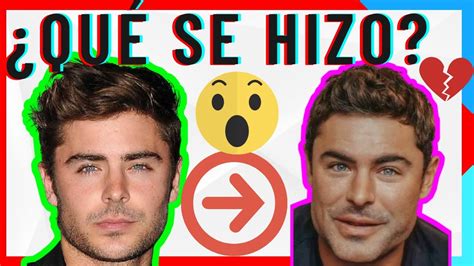 😱 ¿quÉ Le PasÓ A Zac Efron En Su Cara 😱 Impactante Cambio Youtube