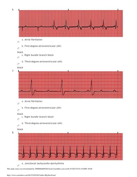 SOLUTION Relias Dysrhythmia Basic A Test Actual Exam With Questions