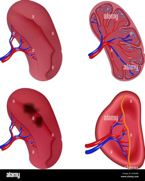 Spleen Milt Anatomy Icons Set Realidtic Illustration Of Spleen Milt