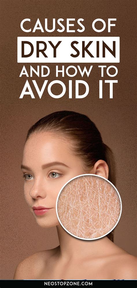 Causes Of Dry Skin On Face Body And How To Avoid It And Its Remedies Dry Skin On Face Lotion