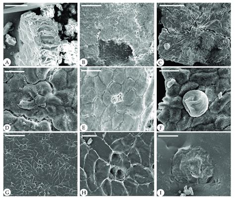 Cuticle Of Fossil Comptonia Hirsuta Under Sem Els A