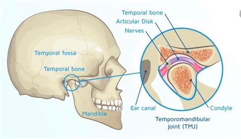 How To Treat Temporomandibular Disorder Tmd