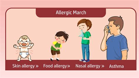 What is Allergic March and How to Treat It?