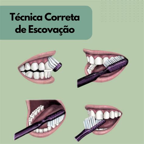 A Técnica Correta de Escovação Cuide Bem dos Seus Dentes Ortocoi