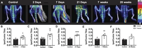 Longitudinal Translocator Protein Kdapositron Emission Tomography