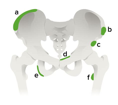 Apophyseal Avulsion Fracture Concise Medical Knowledge