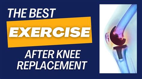 Best Exercise After Knee Replacement Surgery Youtube