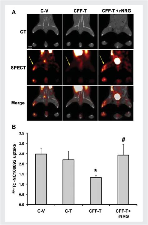 Endothelial NRG Deletion Decreases A V B 3 Activation A