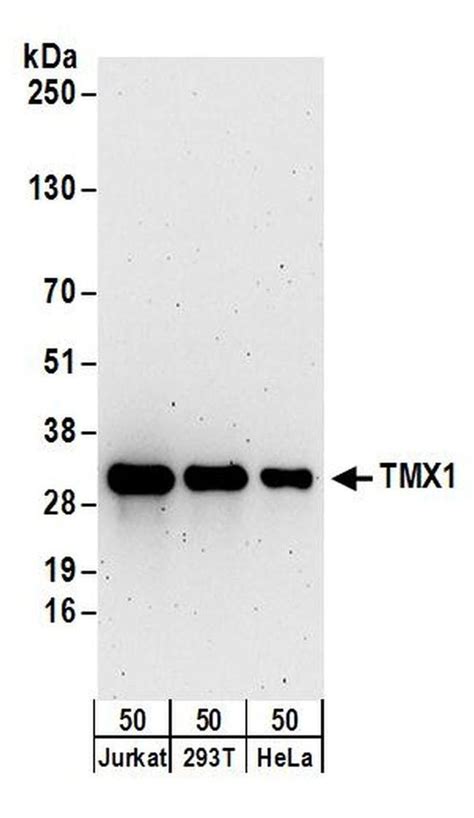 Tmx1 Polyclonal Antibody A304 040a