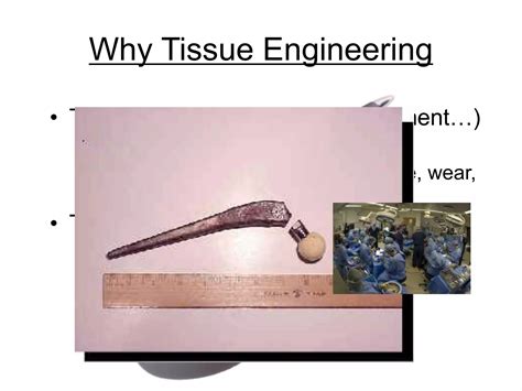 Tissue Engineering And Regenerative Medicine Ppt