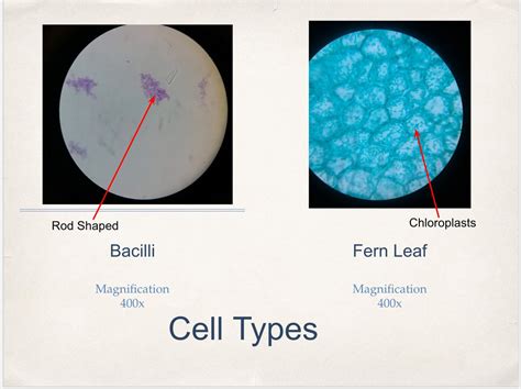 Prokaryotic Vs Eukaryotic Cell Under Microscope