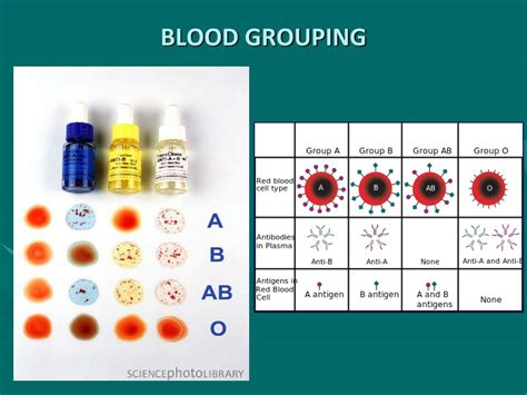 Ppt Blood Transfusion And Transfusion Reactions Powerpoint