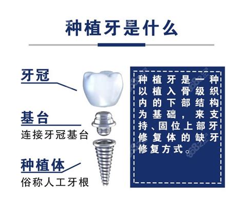 苏州镶牙医院排行前十苏州正规整牙医院镶牙好还便宜牙齿修复 8682整形网