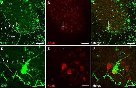 Gfp Labeled Spinal Cord Motor Neuron Co Expressing Neun A