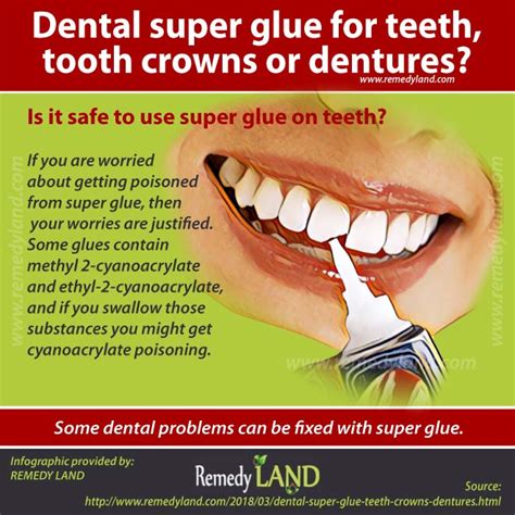 Dental super glue for teeth, tooth crowns or dentures? - Remedy Land