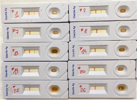 Results Of Giardia Duodenalis Rapid Antigen Test Applied On Faecal