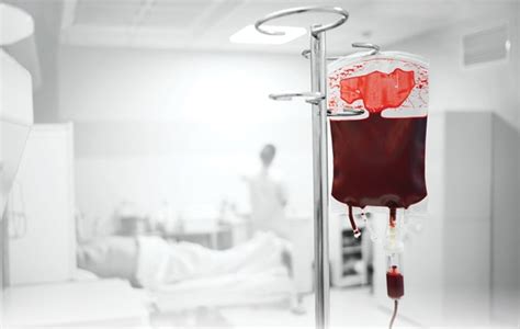 What Is the Optimal Estimated Blood Loss Technique for Major Surgery?