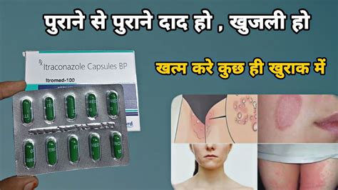 Itraconazole Capsules Mg Itromed Capsule Uses In Hindi