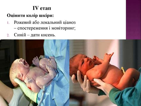 Асфіксія новонароджених - online presentation