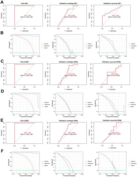 A Lactate Metabolism Related Gene Signature To Diagnose Osteoarthritis