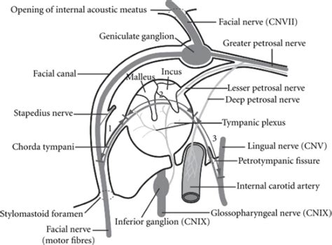 The Sections Of The Chorda Tympani Between The Facial N Open I