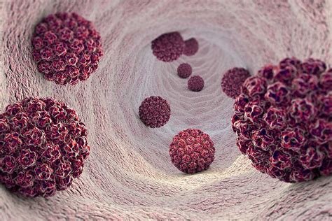 Vaccine profiles: HPV