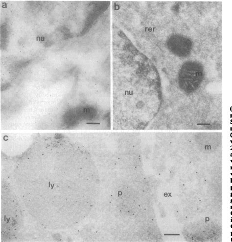 Figure From Copper Zinc Superoxide Dismutase Is Primarily A