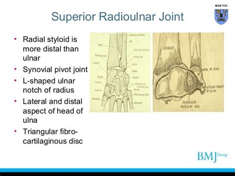 Anatomy of Superior and inferior radioulnar joint