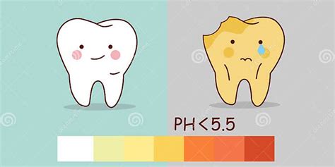 Dientes Sanos Y Caries Ilustración Del Vector Ilustración De Dientes 82640493