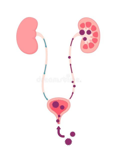 Urinary Tract Infection Stock Illustrations 1 335 Urinary Tract