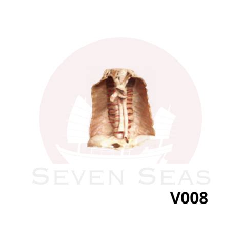 V008 Thoracic aorta and its branches – Seven Seas