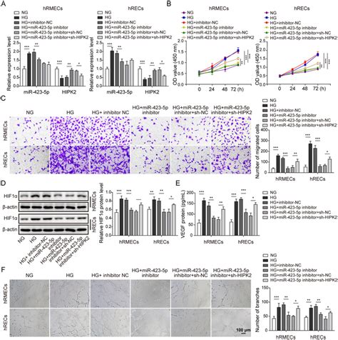 MiR 423 5p Regulated Angiogenesis Via Targeting HIPK2 To Modulate