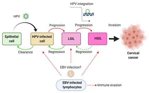 Pathogens Free Full Text Role Of Epstein Barr Virus And Human Papillomavirus Coinfection In