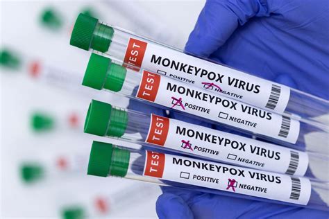 Cdc Identifies Nine Monkeypox Cases In Us Amid Signs Of Local Spread