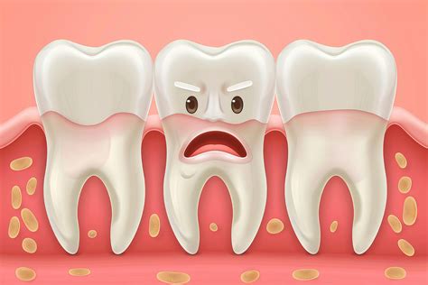 The Main Difference Between Gingivitis Vs Periodontitis Mydental