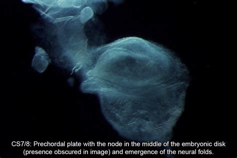 Human Embryo Carnegie Stages