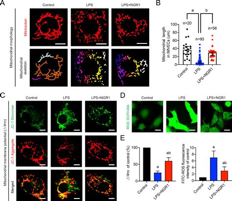 Figure 1 From Notoginsenoside R1 Improves Intestinal Microvascular