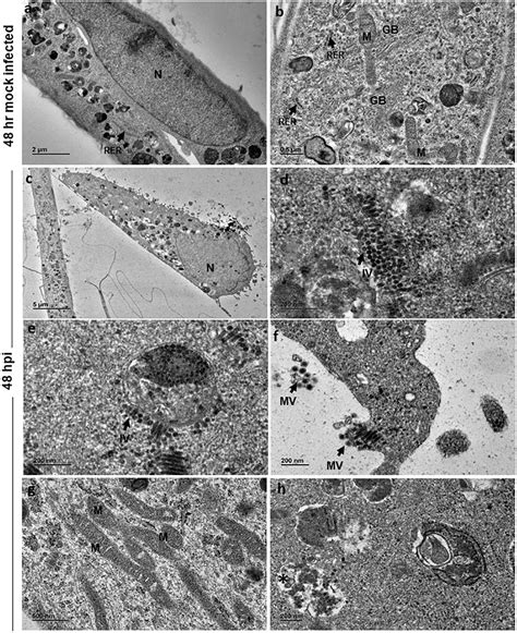 Frontiers Chikungunya Virus Infection In Human Microglial C20 Cells