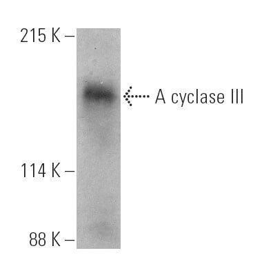 Adenylate Cyclase Ac Adcy E Scbt Santa Cruz Biotechnology